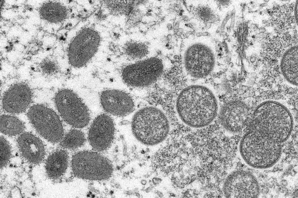 Bildet er av apekopp-virus. Det er tatt under et mikroskop. Foto: Cynthia S. Goldsmith / Russell Regner / CDC / AP / NTB