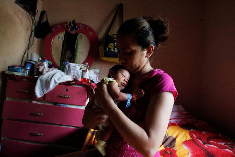 Bildet viser en liten baby sammen med moren sin. Babyen er født med for liten hodeskalle etter at moren ble smittet av Zika-virus.