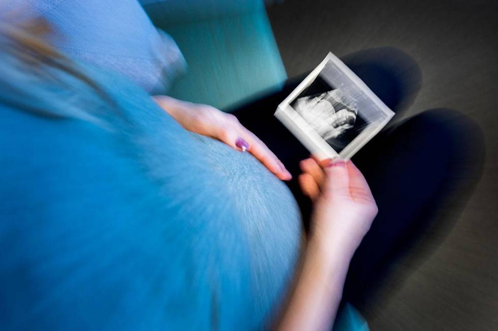 Bildet viser en gravid kvinne med et bilde fra ultralyd av fosteret.